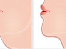 Ever-Known-That-Double-Chin-Can-Be-Cured-This-Way