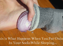 Onions-At-The-Bottom-Of-Your-Feet-While-Sleeping