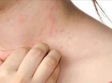 10-symptoms-you-may-have-parasites-in-your-body-and-how-to-remove-them