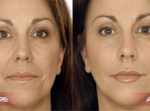 Natural-Recipe-Save-You-From-Wrinkles-Within-7-Days