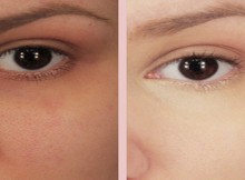 Baking-Soda-Under-Your-Eyes
