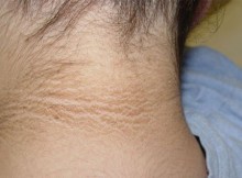 Natural-Recipes-For-Dark-Neck-That-Are-Home-Made
