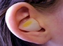 This-Is-What-Happens-When-You-Put-An-Onion-In-Your-Ear-Overnight