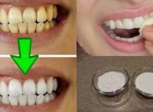 20-whiten-your-teeth-naturally-fb-918x482-780x410-600x315