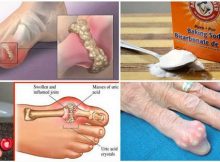 How-To-Quickly-Remove-U -Gout-And-Joint-Pain