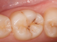 Rub-These-Two-Oils-on-You-need-to-go-to-a-dentist-again