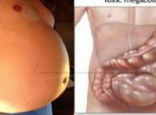 Your-Are-Not-Fat-Your-Stomach-Is-Bloated-And-Here-Is-How-To-Get-Rid-Of-It