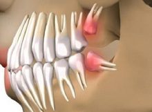 dental-growww