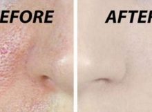 Clean-And-Open-Your-Pores-Naturally-With-3-Simple-Steps-That-You-Can-Do-At-Home-33294-2