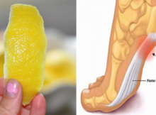 Lemon-Peels-Can-Help-Remove-Joint-Pain-In-Ways-You-d-Never-Imagine-remedy