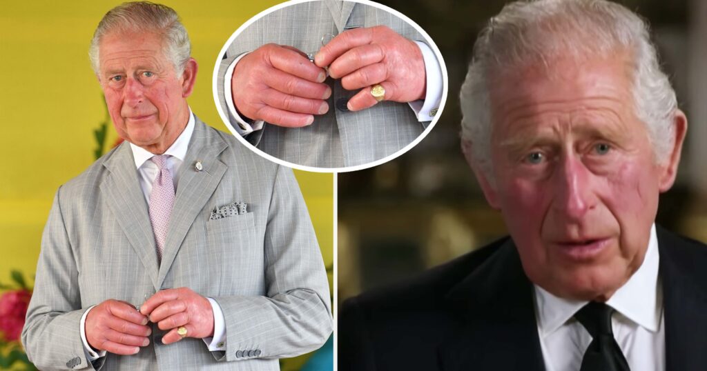 King Charles' fingers "sausage" raises concerns. According to the Queen