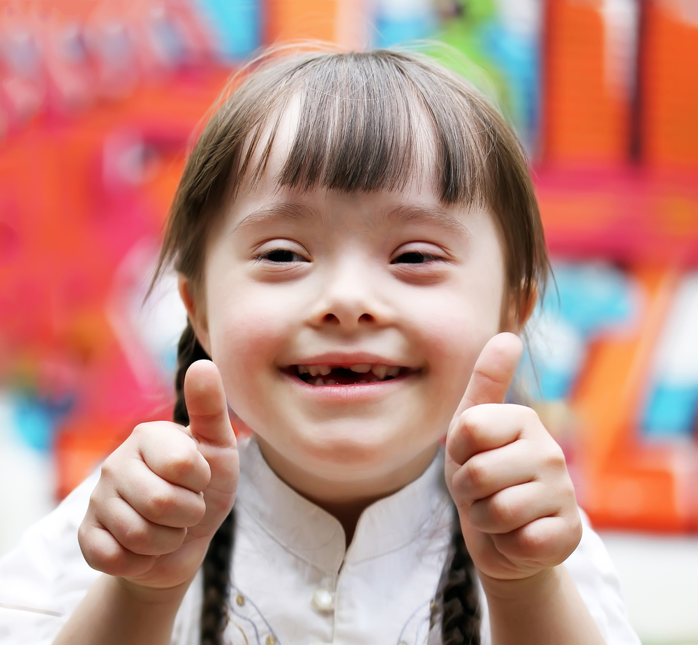Portrait,Of,Beautiful,Disabled,Girl,That,Giving,Thumbs,Up.